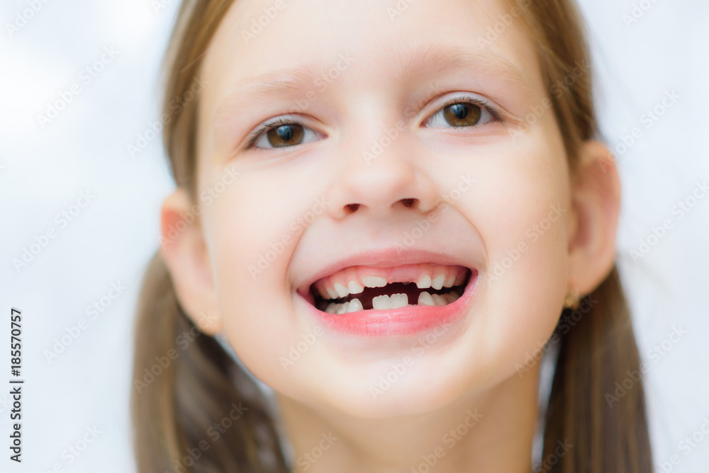funny toothless girl laughing with his mouth open funny toothless girl laughing with his mouth open