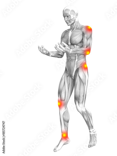 Conceptual human muscle anatomy with red and yellow hot spot inflammation or articular joint pain for health care therapy or sport concepts. 3D illustration man arthritis or bone osteoporosis disease © high_resolution