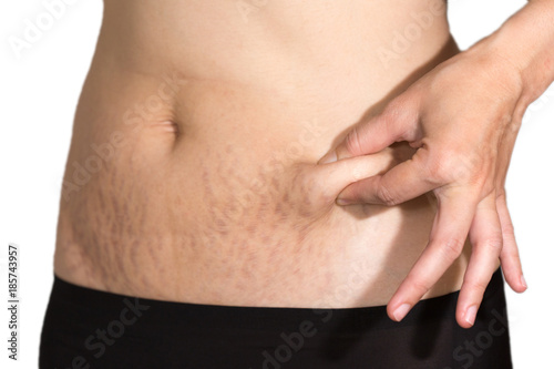 Woman belly fat pattern