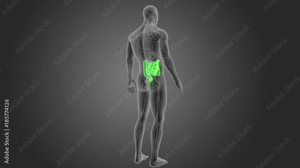 Intestine with CS Intestine with CS