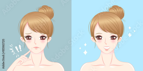 woman with mouth wrinkles problem