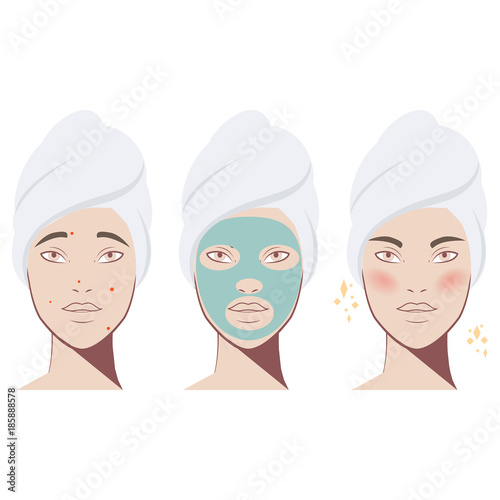 Beauty girl. Acne treatment before after, facial cleansing foam, cartoon illustration. Face mask