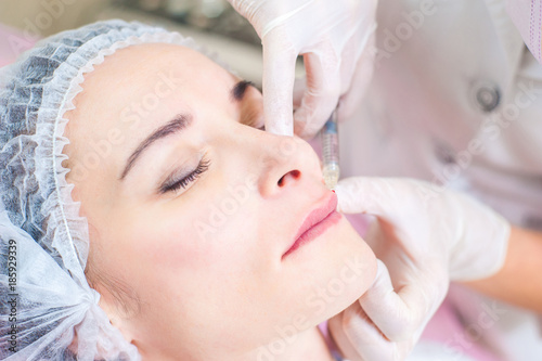 .Lip augmentation, cosmetology, beauty, plastic surgery