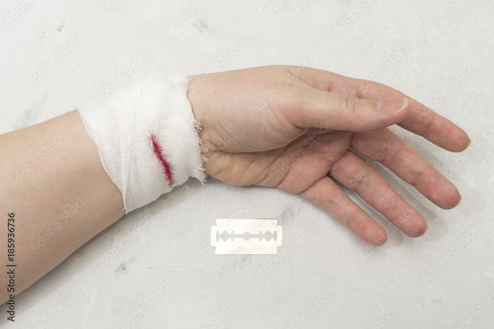 Hand with bandage on the wrist. Blood from a wound. Photos | Adobe Stock