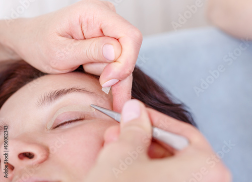 Surgeon applies a bandage to the female patient's eyelids after a blepharoplasty operation