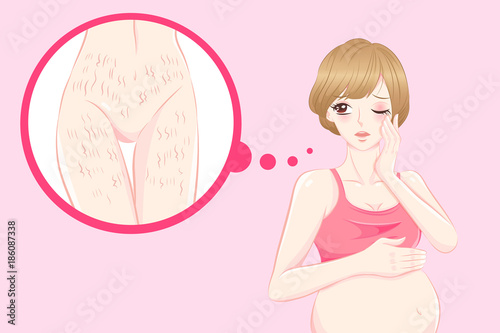 woman with stretch mark skin