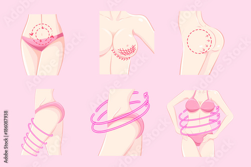 woman with body plastic surgery