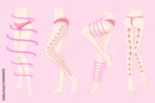 woman with body plastic surgery