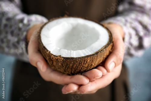 Woman holding coconut half, closeup
