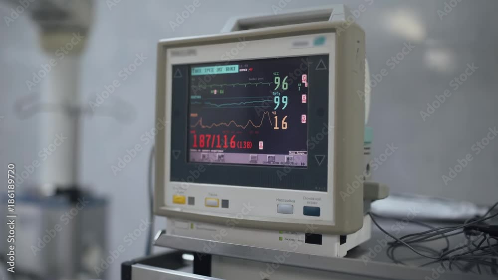 Hospital, monitor for monitoring the basic parameters of the human body, medical equipment.
Hospital, monitor for monitoring the basic parameters of the human body, medical equipment.