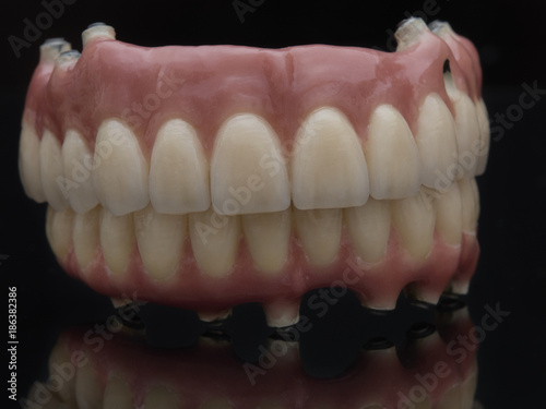  Complete prosthesis dental screwed over black mirror. Reflection