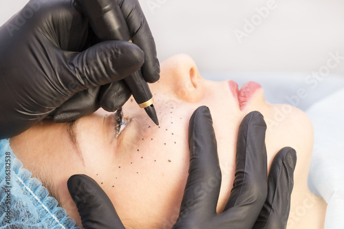 Permanent microblasting tattooing freckles to a woman in a beauty salon photo