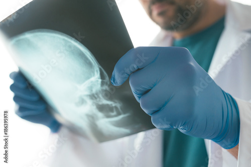 Doctor examining x-ray of the skull photo