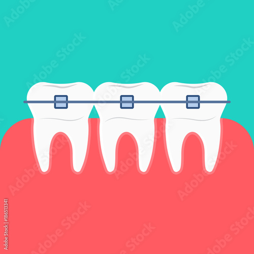 Teeth braces vector icon.