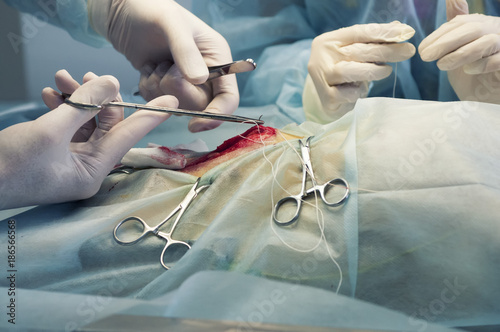 Doctors perform the operation. Surgery. Sewing the incision in the abdominal cavity.