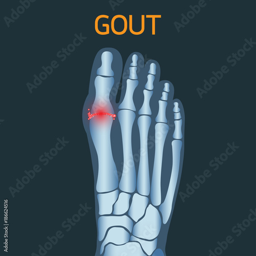 Gout vector logo icon illustration