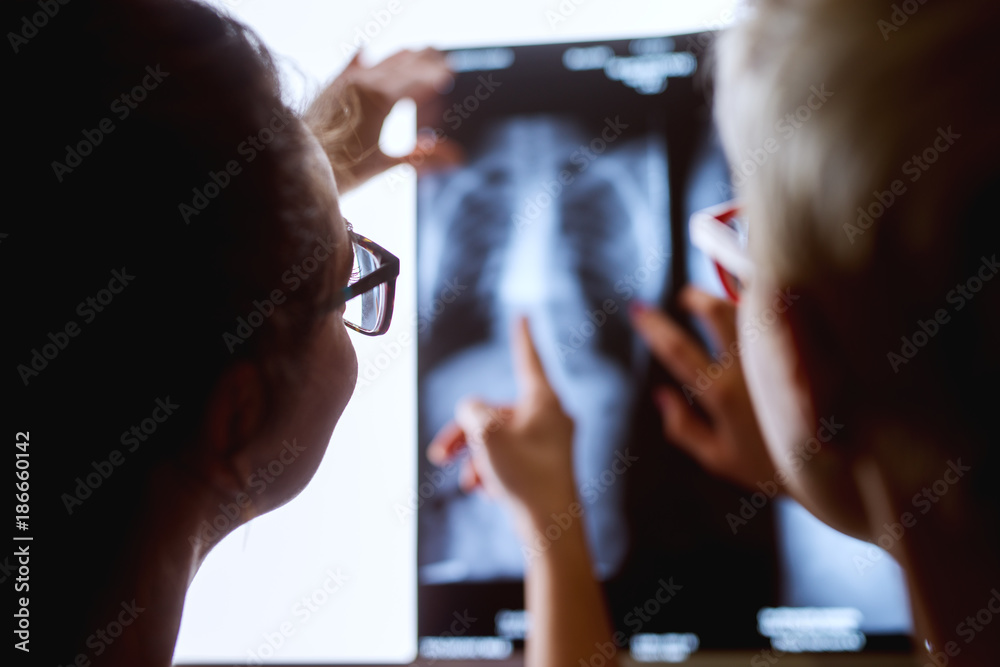 Φωτογραφία Rear close up view of two professional nurses with eyeglasses showing with fingers on the x-ray of a patient