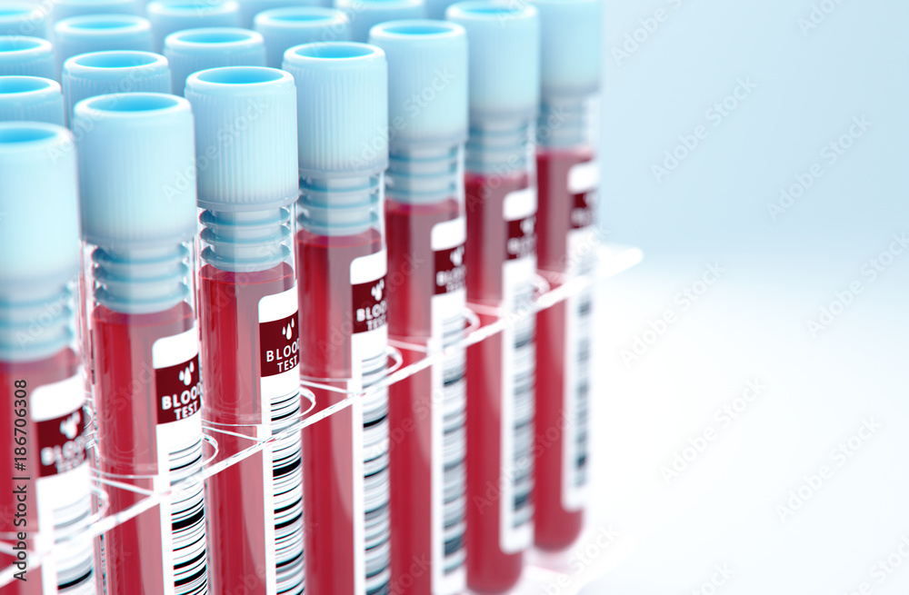 Medical test tubes with blood in holder on white background,3d rendering. Medical test tubes with blood in holder on white background,3d rendering.
