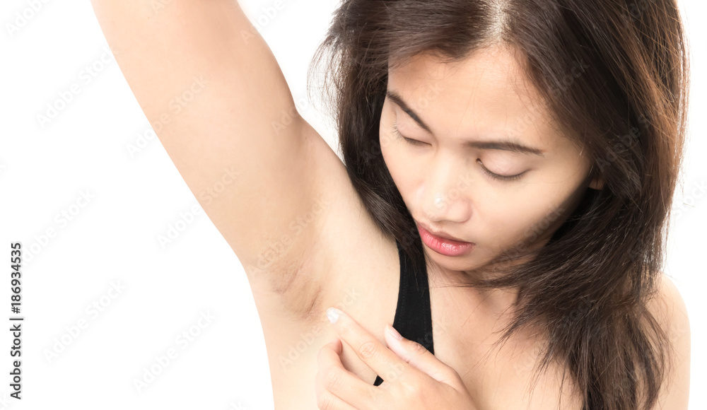 Women problem black armpit on white background for skin care and beauty concept Women problem black armpit on white background for skin care and beauty concept
