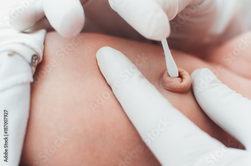 Fotografie Mom or a doctor wearing gloves to handle the navel baby