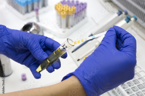 Clinical urine test in a laboratory photo