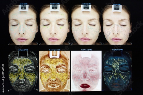 Scan of young woman's face in skin clinic