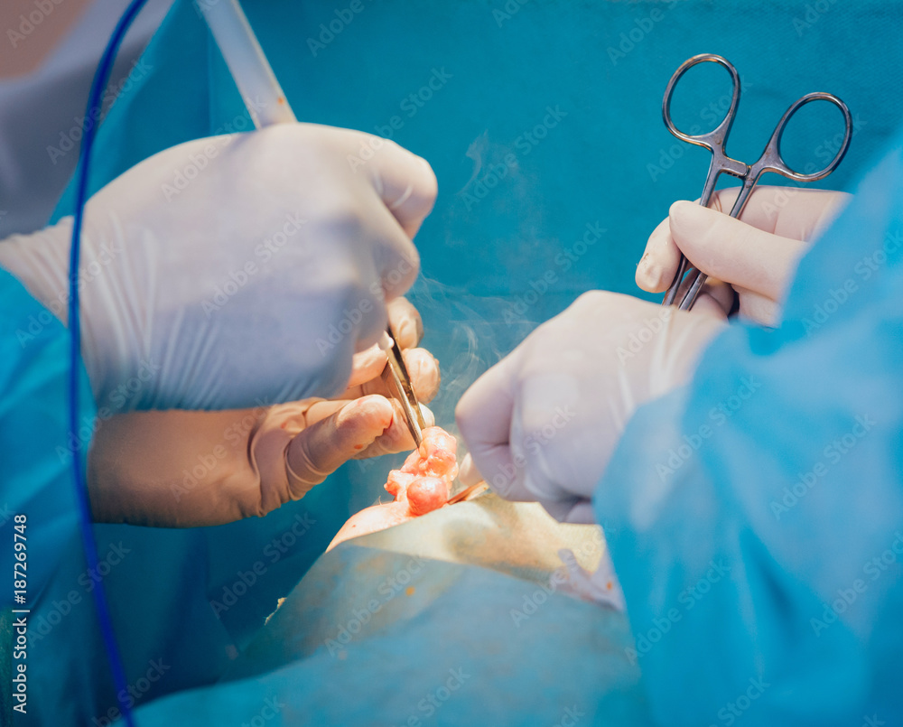 Breast surgery in the operating room. Breast surgery in the operating room.