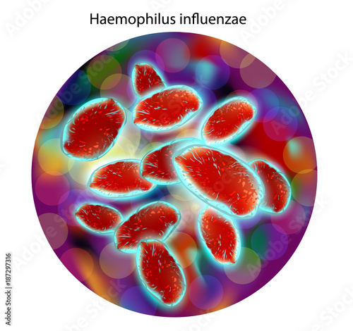 Haemophilus influenzae bacteria Gram-negative coccobacilli which cause infections mainly in children, pneumonia, otitis, meninitis photo
