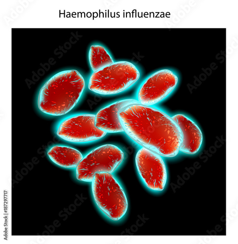 Haemophilus influenzae bacteria Gram-negative coccobacilli which cause infections mainly in children, pneumonia, otitis, meninitis