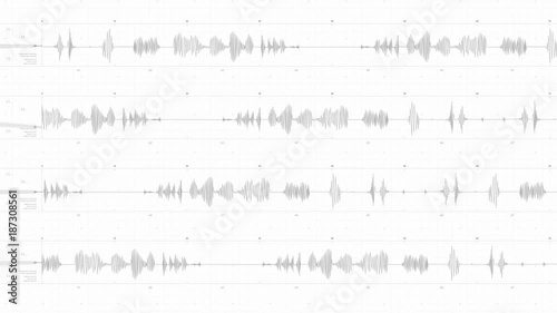 Lie Detector, Polygraph With Alpha Channel
