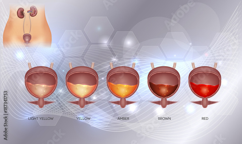 Urinary bladder and various urine colors from light yellow till red color. Urinary bladder detailed anatomy and urine inside on an abstract glowig background