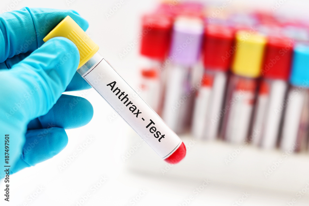 Naklejka premium Test tube with blood sample for anthrax bacteria test