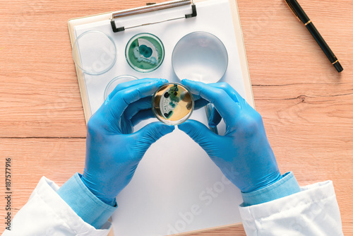 Quadro em tela Overhead view of laboratory technician analyzing petri dish bacterial cultures