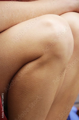 tingling of the skin feet