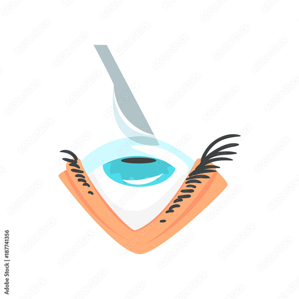 Scalpel over human eye, eye surgery and vision correction cartoon