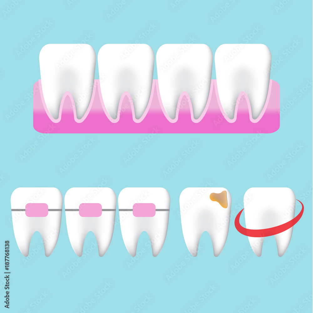 Whitening tooth character illustration on blue background. Whitening tooth character illustration on blue background.