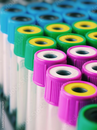 There are many Test Tubes with multicolor lids on the Test Tube rack. Macro photo with Test Tube for blood photo