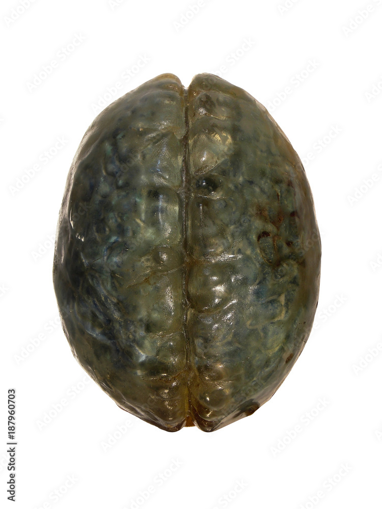 glass brain top glass brain top