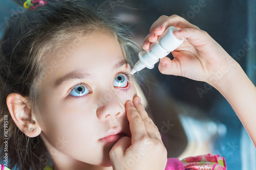 Beautiful child dripping in eye drops conjunctivitis