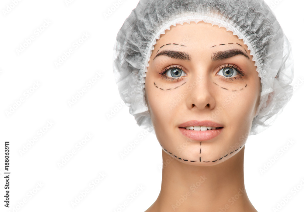 Plastic surgery concept perforation lines on face girl with blue eyes Plastic surgery concept perforation lines on face girl with blue eyes