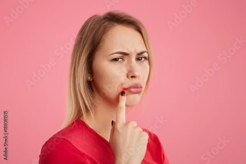 Discontent young beautiful female with unhappy look, has oral herpes, indicates at wound near lips, stands sideways against pink background. People, skin care and health problems concept. photo