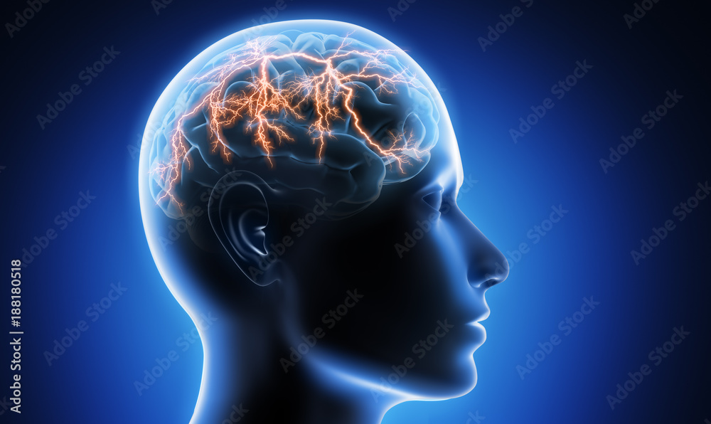 Migräneanfall - Kopfschmerz - obrazy, fototapety, plakaty 