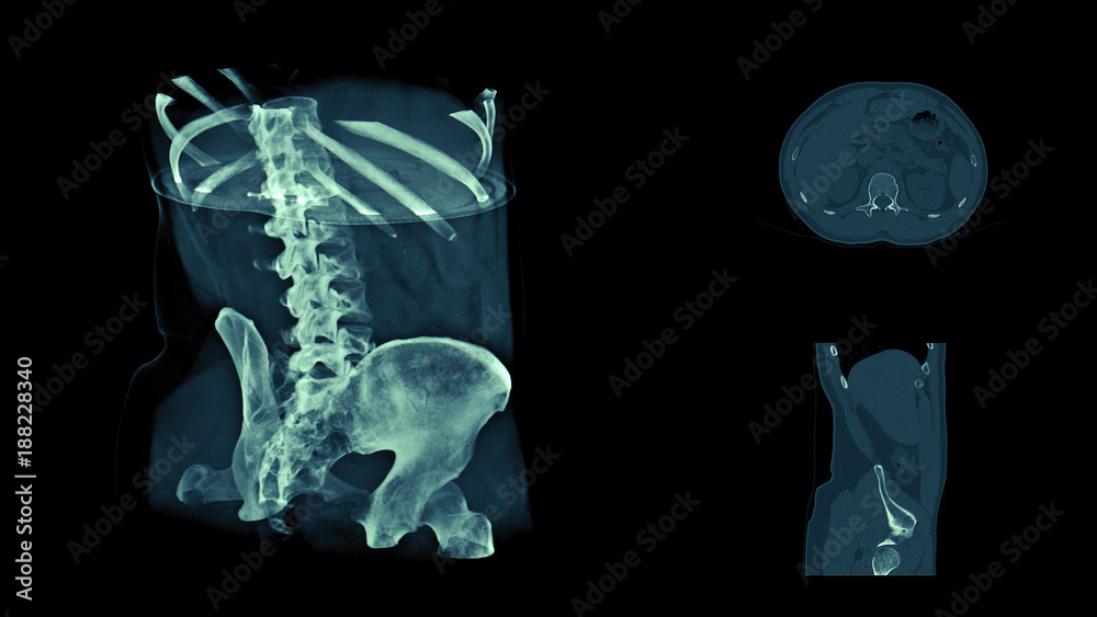 Body CT scan image, radiography xray examination, MRI tomography, 3d