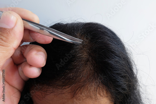 Woman's hand with tweezers plucking gray hair roots