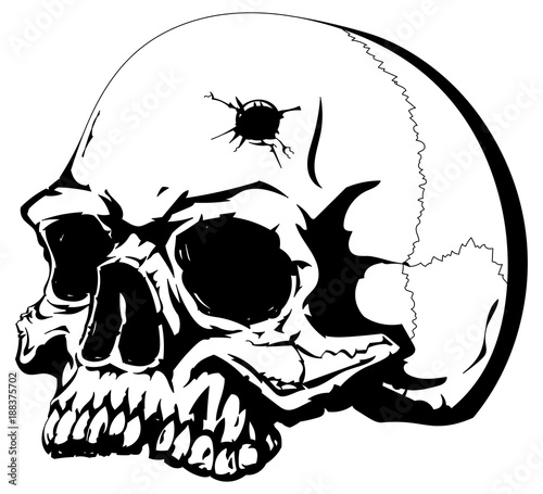 Human skull with a bullet hole on the forehead.