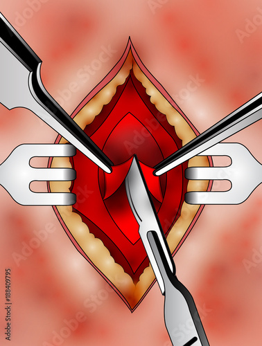 Surgery Vector illustration