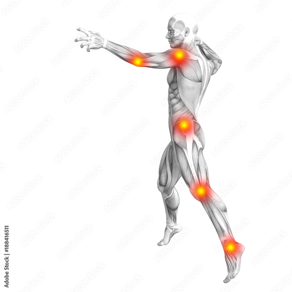 Conceptual human muscle anatomy with red and yellow hot spot inflammation or articular joint pain for health care therapy or sport concepts. 3D illustration man arthritis or bone osteoporosis disease Conceptual human muscle anatomy with red and yellow hot spot inflammation or articular joint pain for health care therapy or sport concepts. 3D illustration man arthritis or bone osteoporosis disease