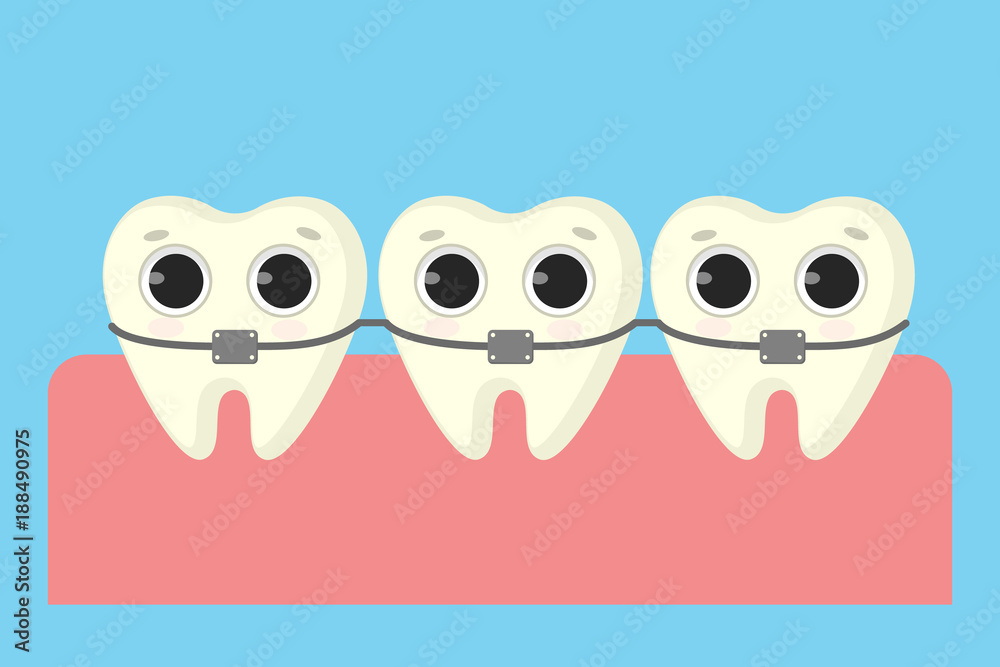 Teeth in braces. Teeth in braces.