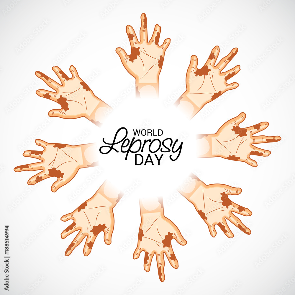 Fototapeta premium World Leprosy Day