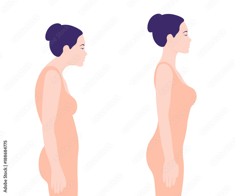 570+ Woman Bad Posture Stock Illustrations, Royalty-Free Vector Graphics &  Clip Art - iStock